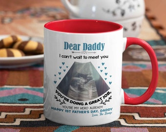 Dear Daddy Mug, Happy 1st Father’s Day Gift, Custom Ultrasound Photo Mug, Custom Name Mug, Gift from Bump, Mug for Father, Gift for Him