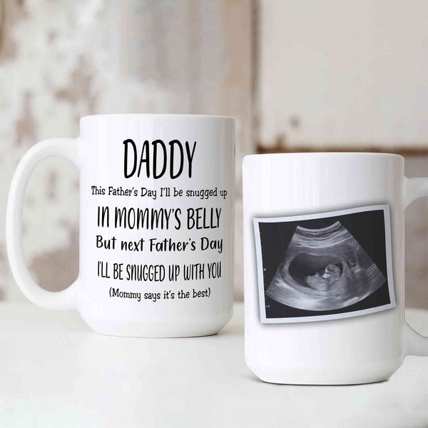 Personalized Ultrasound Photo Mug, Father's Day Mug, Ultrasound Mug Father, Sonogram Mug, Pregnancy Announcement, Mug For Father, Grandpa