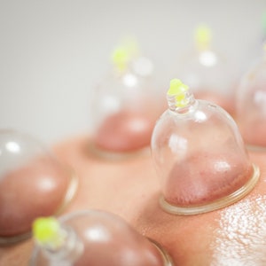 100x Schröpfgläser 1x Pumpe, Hacamat Kupası Seti, Hijama Massage Schröpfen, Cupping Cups, Schröpfglas Bild 9