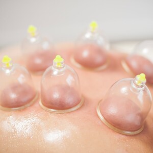 Cuppingset, 400x cuppingglazen 1x pomp, Hacamat Kupası Seti 400 Kupa 1 Pompa afbeelding 8