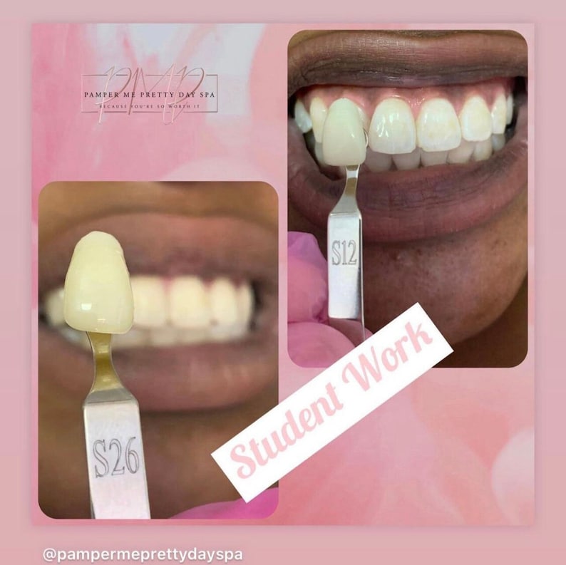Teeth Whitening Kit Professional Training Teeth Whitening Etsy