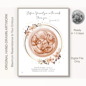 Custom Embryo Art IVF Drawing Personalized Pregnancy Loss Gift Nursery Wall Art Print Ultrasound art Baby Shower Decor Infertility Gift