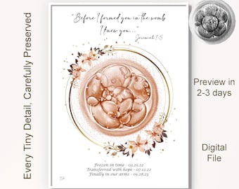 Custom Embryo Art Print, Embryo Drawing from Photo, Personalized IVF Keepsake, Fertility Gift, Digital