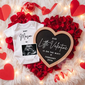 Valentine’s Day Baby Announcement Digital Template with Ultrasound, Editable Pregnancy Reveal for Social Media & Printable Card