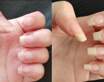 ACEITE MILAGROSO PARA EL CRECIMIENTO - 10 ml