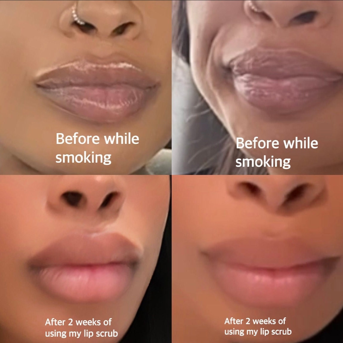 Lightening Lip Scrub Dark Lips Smokers Lip Scrub Etsy