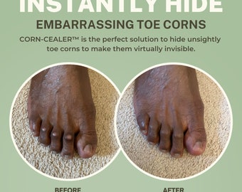 Instantly Hide Toe-Corns With This Makeup Made Just For Toes