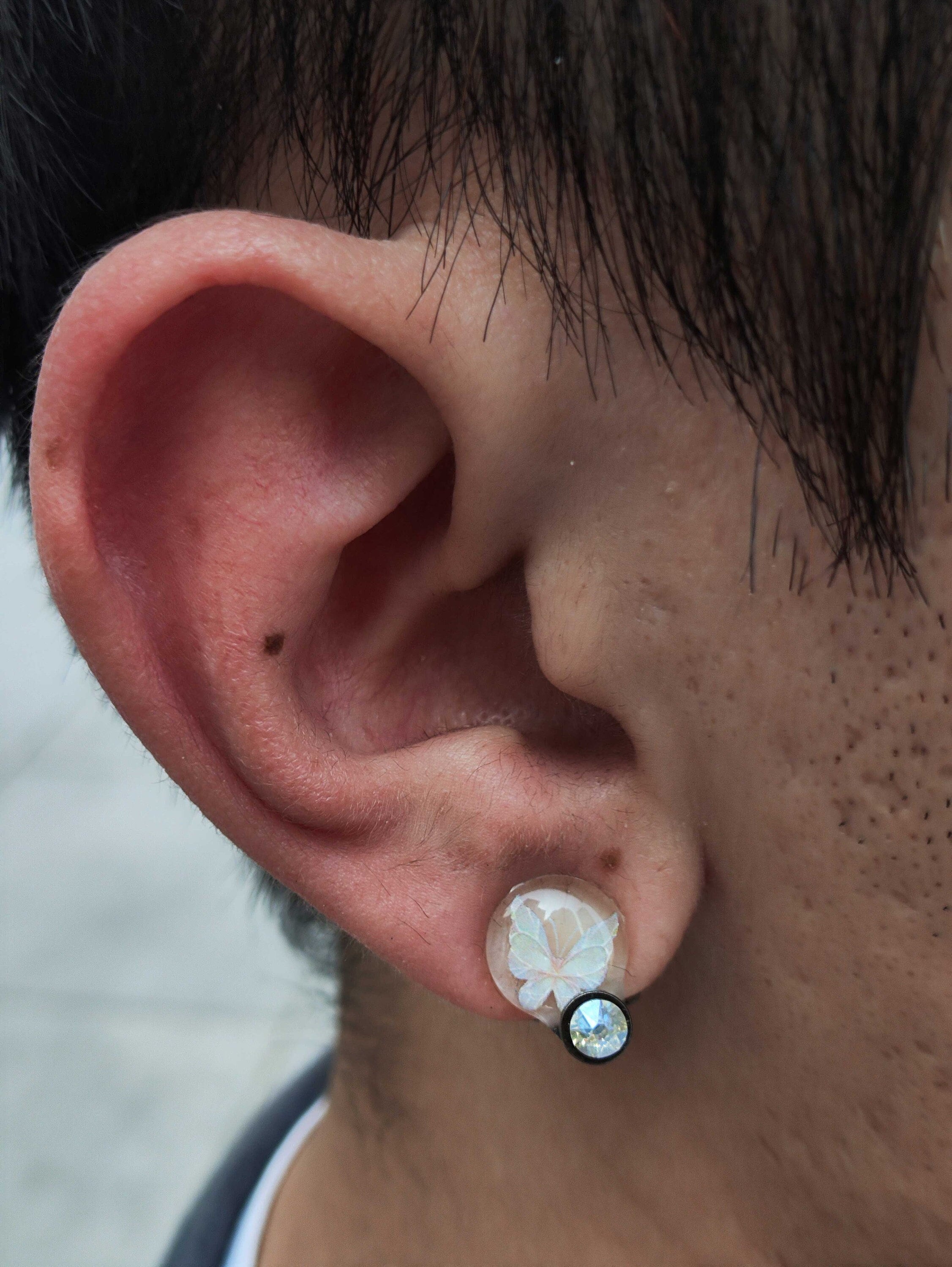 Gold keloid pressure earring • Keloid cartilage earring • Keloid