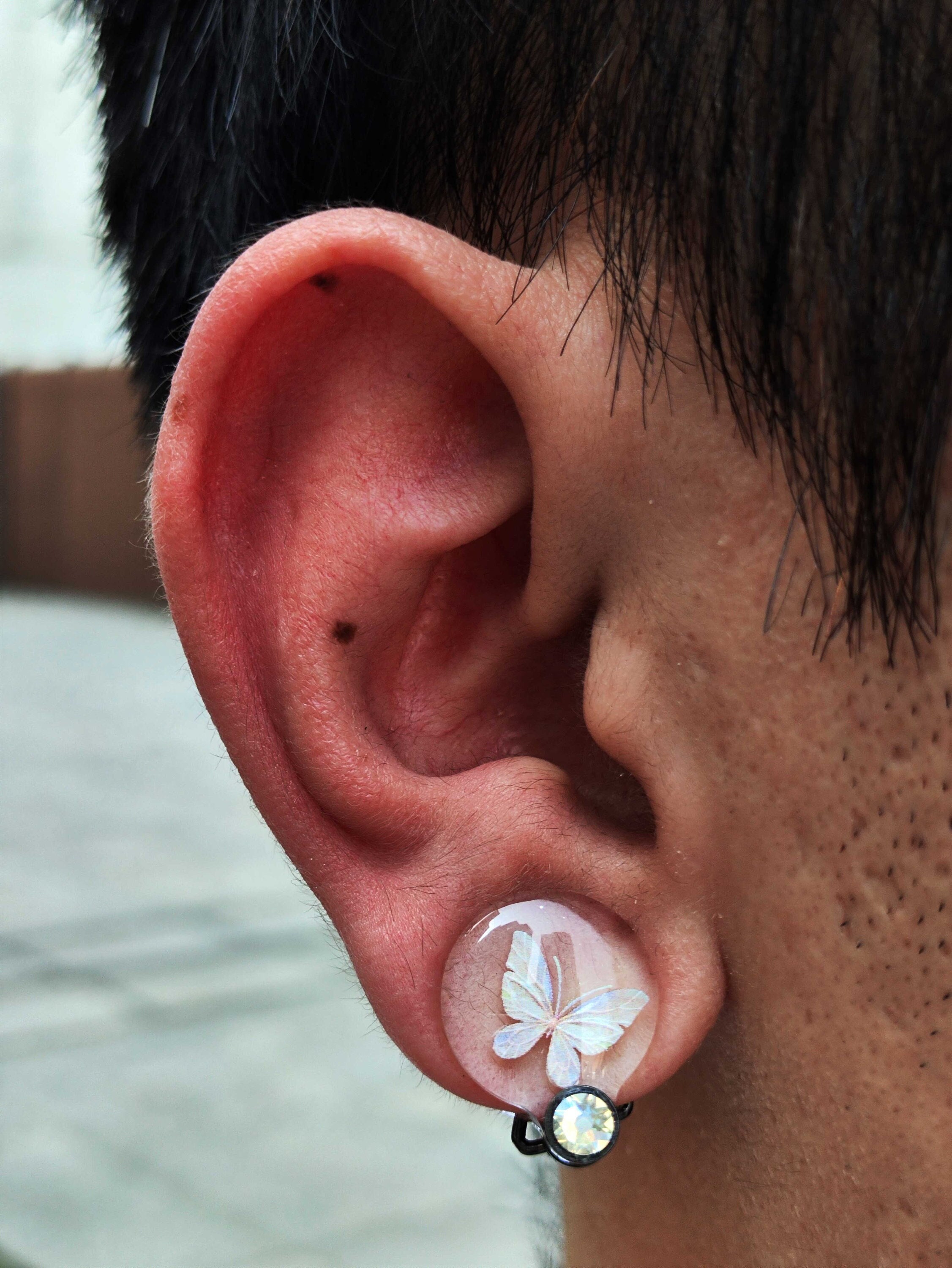 15mm 0.59 NEW DESIGN Keloid Earring Compression. Pressure Keloid Clips