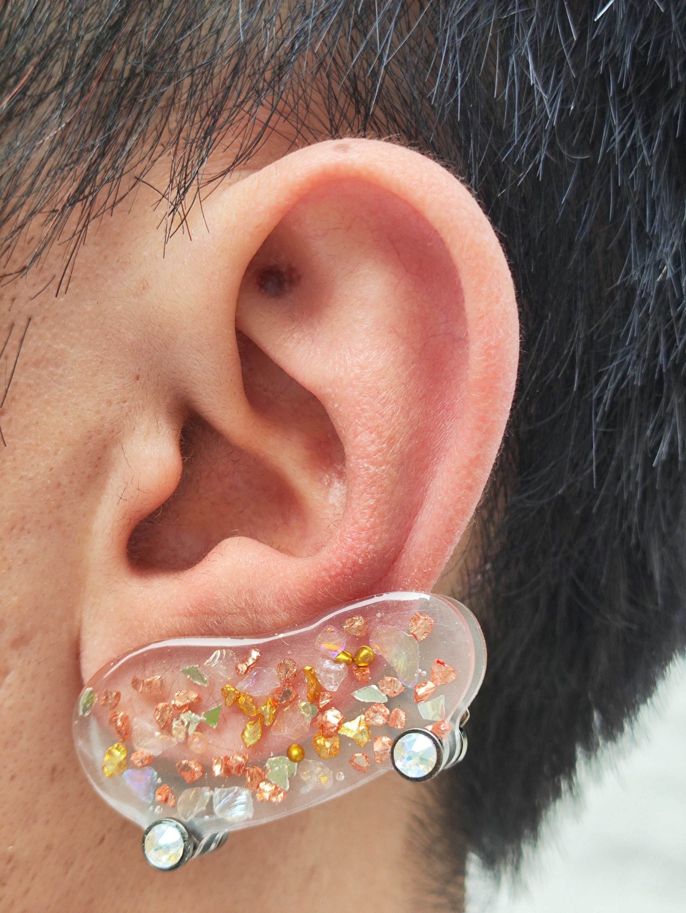 20mm 0.79 Keloid Earring Compression. Keloid Prevention Earring