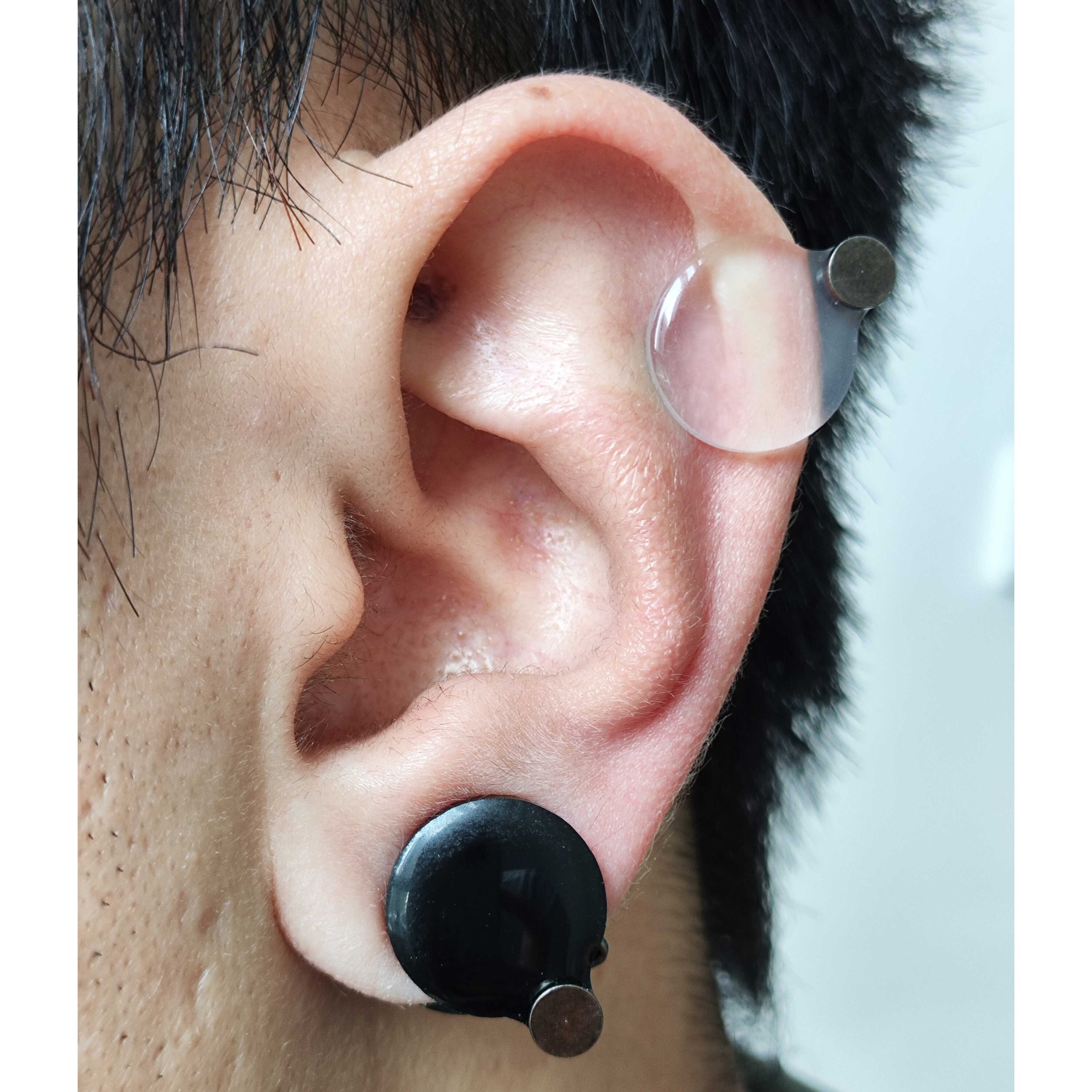 Ear Keloid Compression Plastic Discs Plastic Disc Earring for Post-op Keloid  Pressure'smiley' Shape 