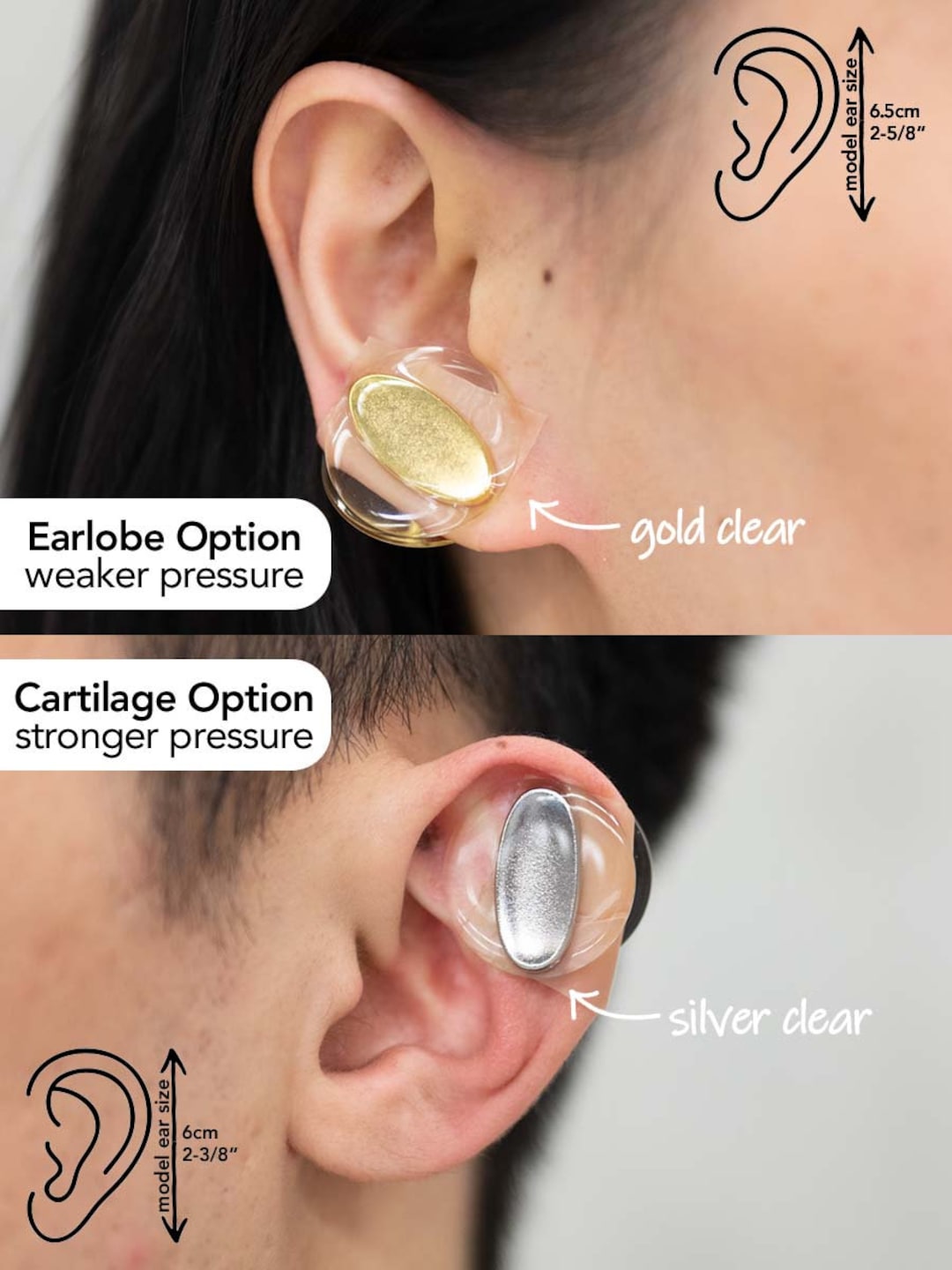 Keloid Clip. Keloid Scar Compression Earring. Best Earrings Etsy UK