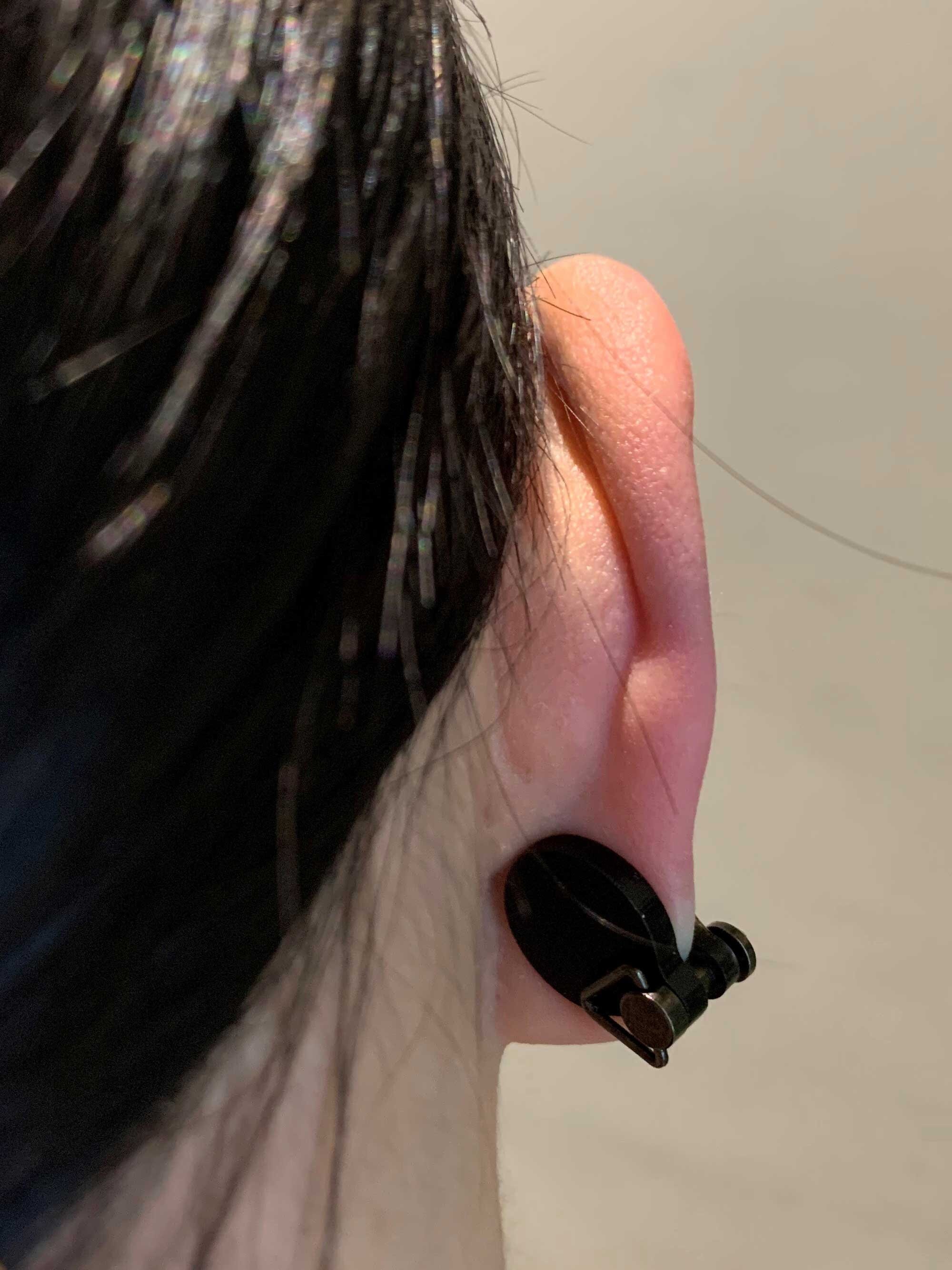 15mm 0.59 Keloid Earring Compression. Pressure Keloid Clips. Keloid