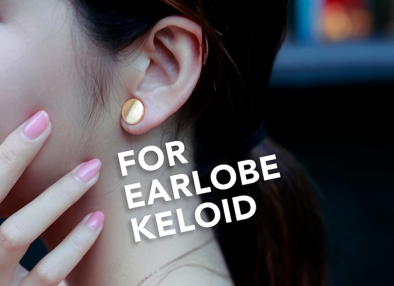 Keloid Pressure Earring Keloid Compression Earring Clip on Etsy