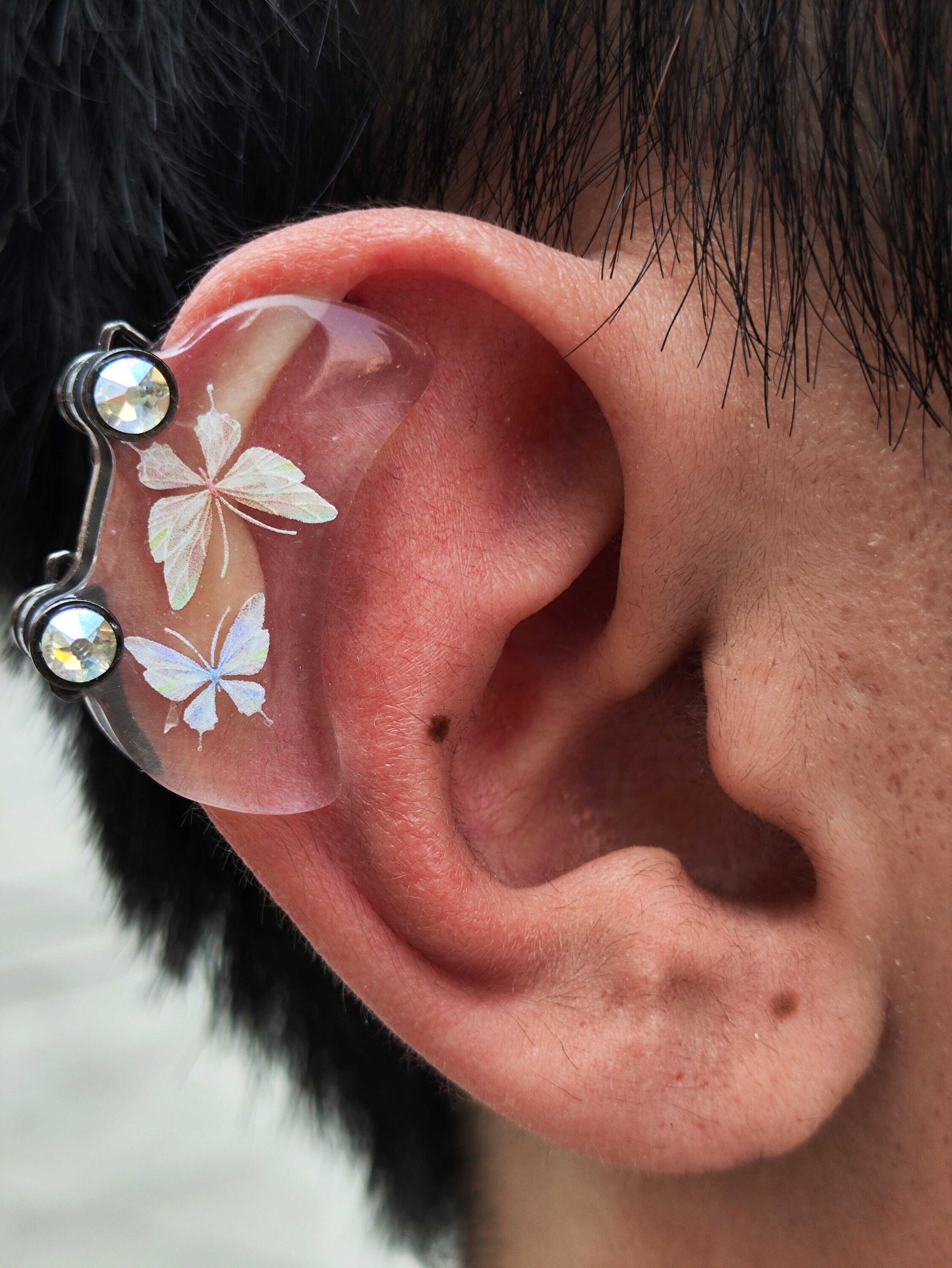 Ear Keloid Custom Acrylic Compression Pressure Earring, Made to Fit,  Flatten Keloid, Scar Management, Ear Scar Management 