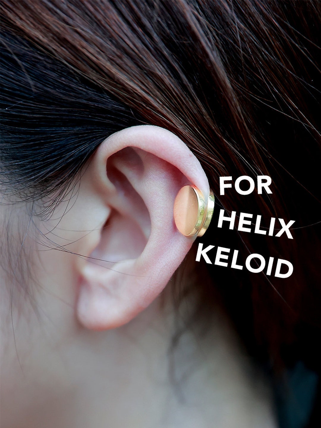 Ear Compression for Keloids GOLD PLATED Keloid Etsy UK