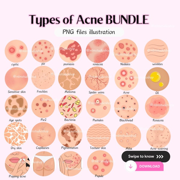 Type of Acne clipart (INSTANT download), Skin icon,  Skincare illustration, PNG files