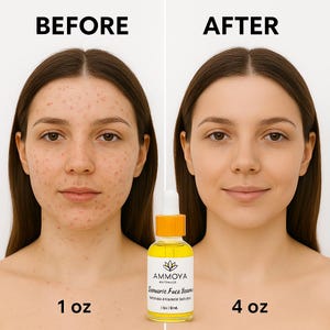 K&ouml;nnte beinhalten: Vorher-Nachher-Fotos eines Gesichts, die die Auswirkungen der Verwendung eines 30 ml Turmeric Face Serums von Ammoya zeigen. Die Flasche ist gelb mit einem schwarzen Etikett und einem wei&szlig;en Blumenlogo.