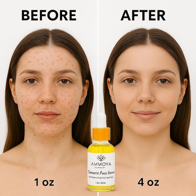 K&ouml;nnte beinhalten: Vorher-Nachher-Fotos eines Gesichts, die die Auswirkungen der Verwendung eines 30 ml Turmeric Face Serums von Ammoya zeigen. Die Flasche ist gelb mit einem schwarzen Etikett und einem wei&szlig;en Blumenlogo.