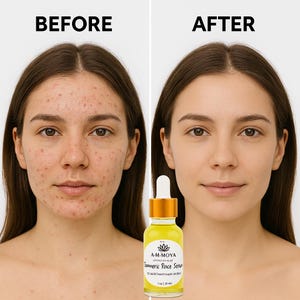 K&ouml;nnte beinhalten: Vorher-Nachher-Fotos eines Gesichts, die die Auswirkungen der Verwendung eines Kurkuma-Gesichts-Serums zeigen. Das Serum befindet sich in einer durchsichtigen Glasflasche mit goldener Kappe und einem Etikett mit der Aufschrift "A-M MOYA Turmeric Face Serum 1 fl oz | 30 ml".