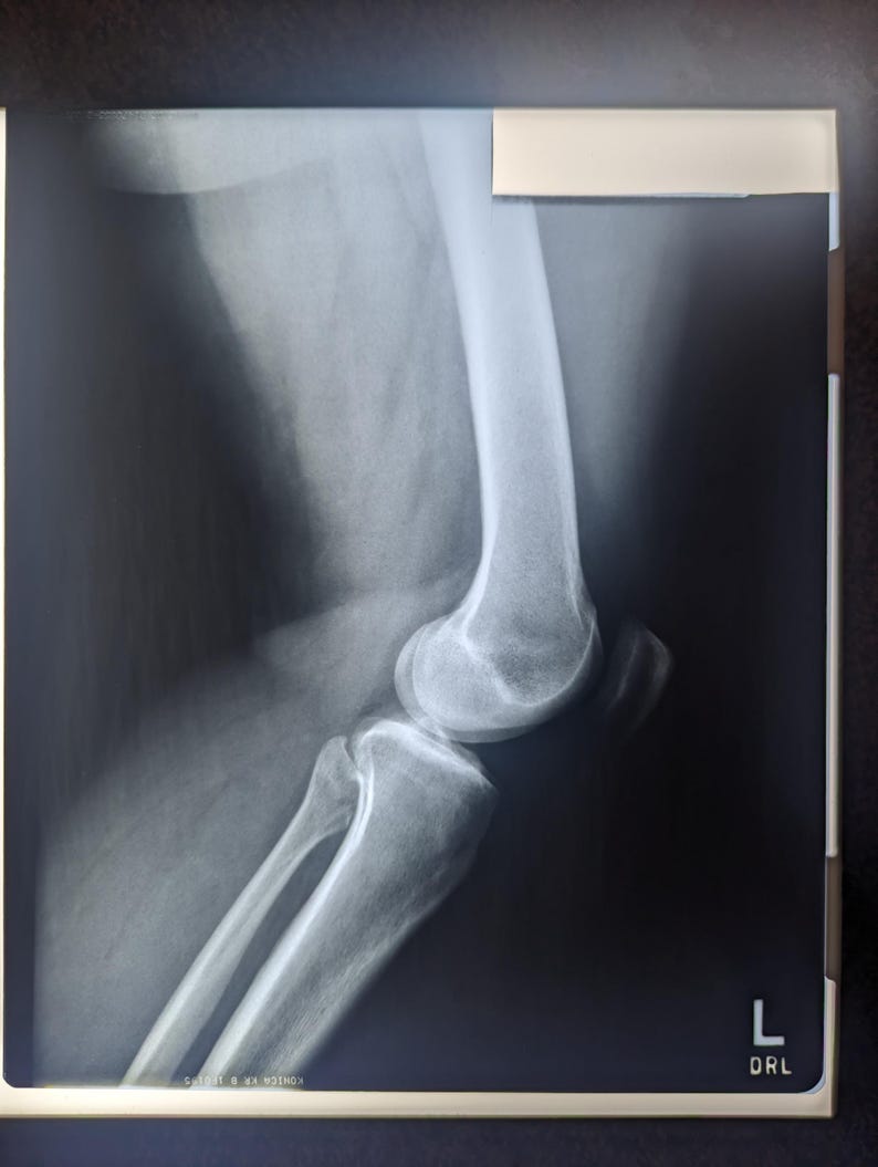 Vintage Xray Film Etsy