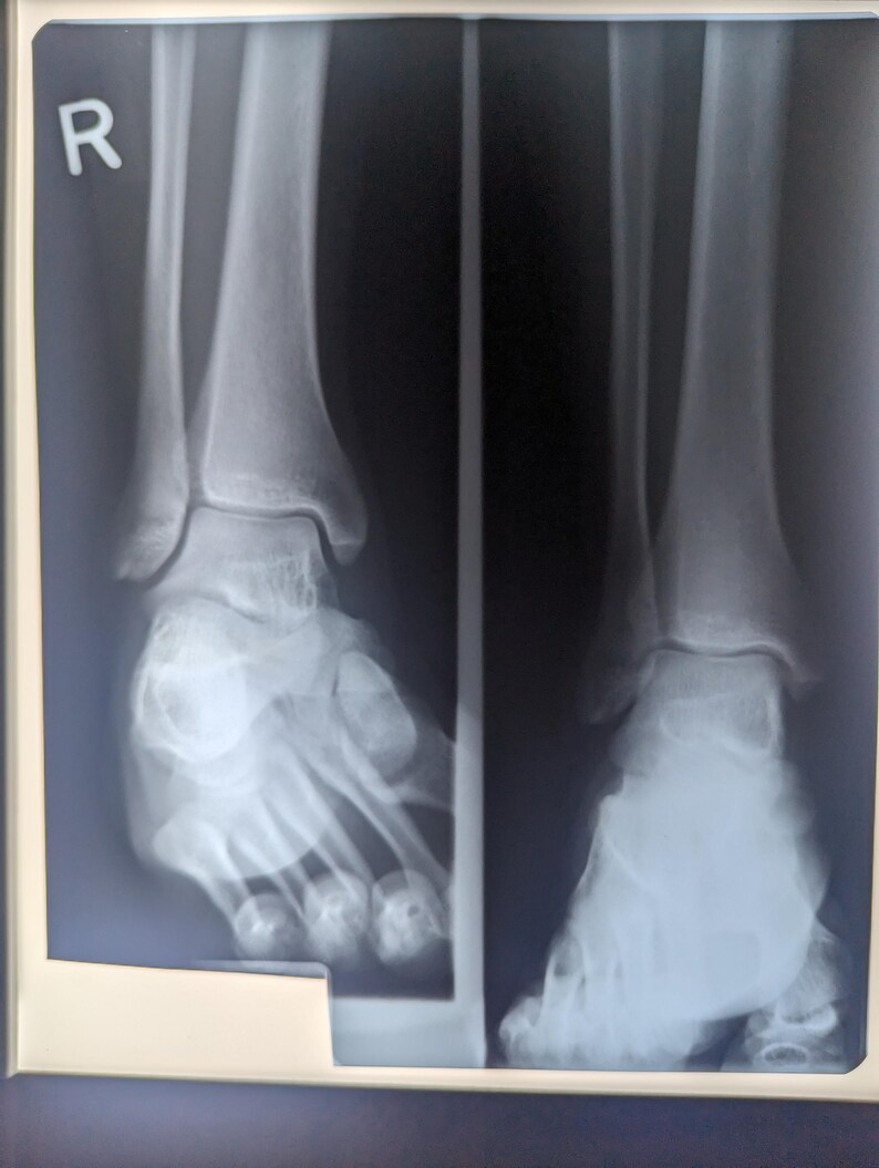 Vintage Xray Film Etsy