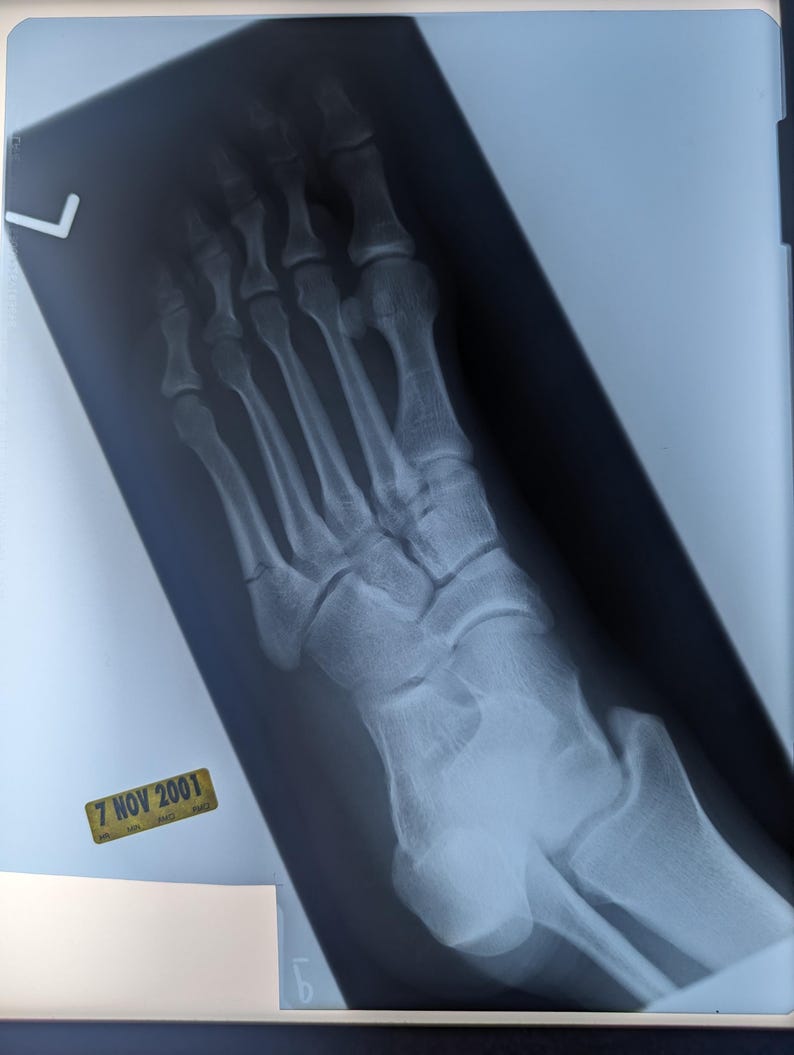 Vintage Xray Film Etsy