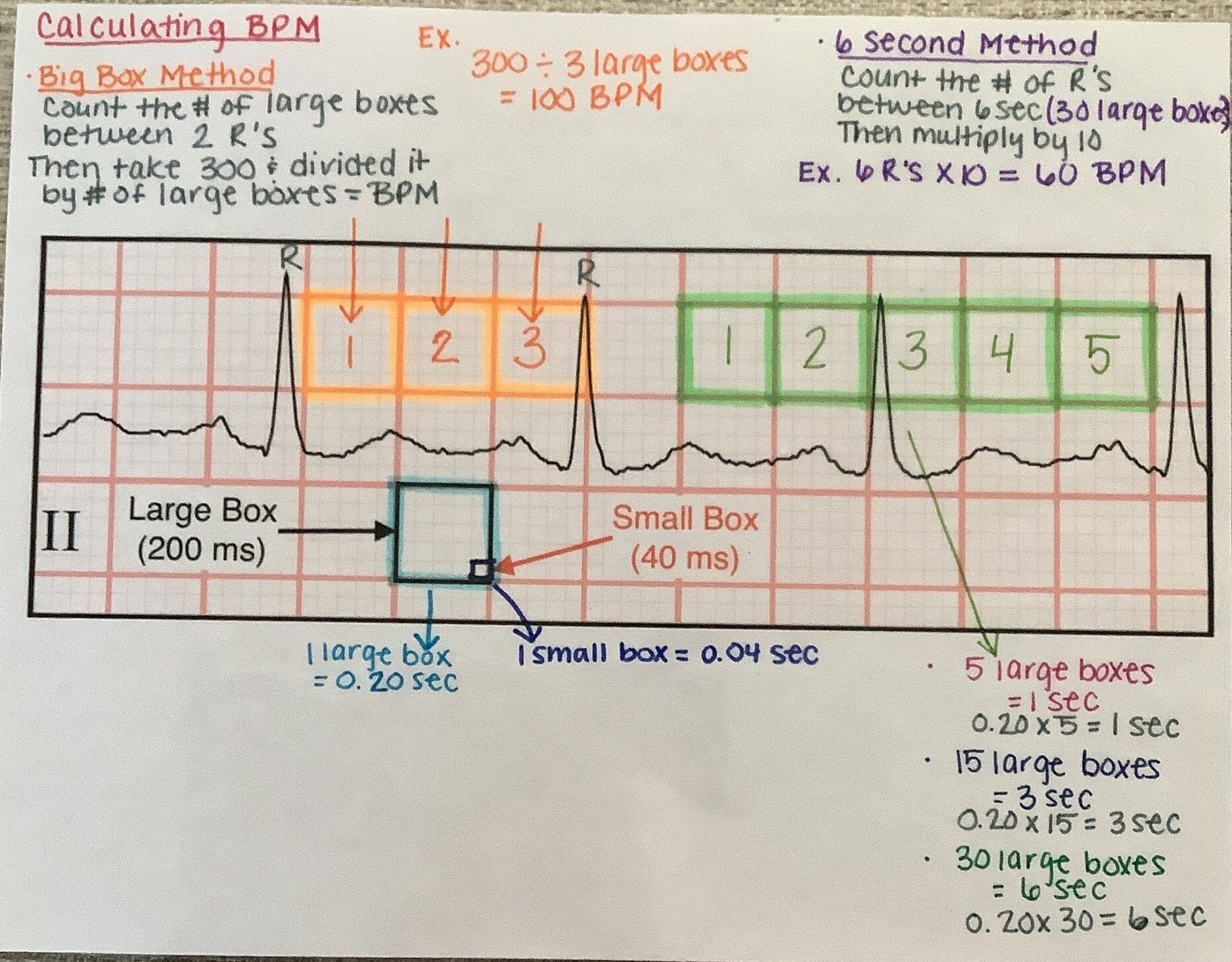 How to Measure and Understand Ekgs Etsy