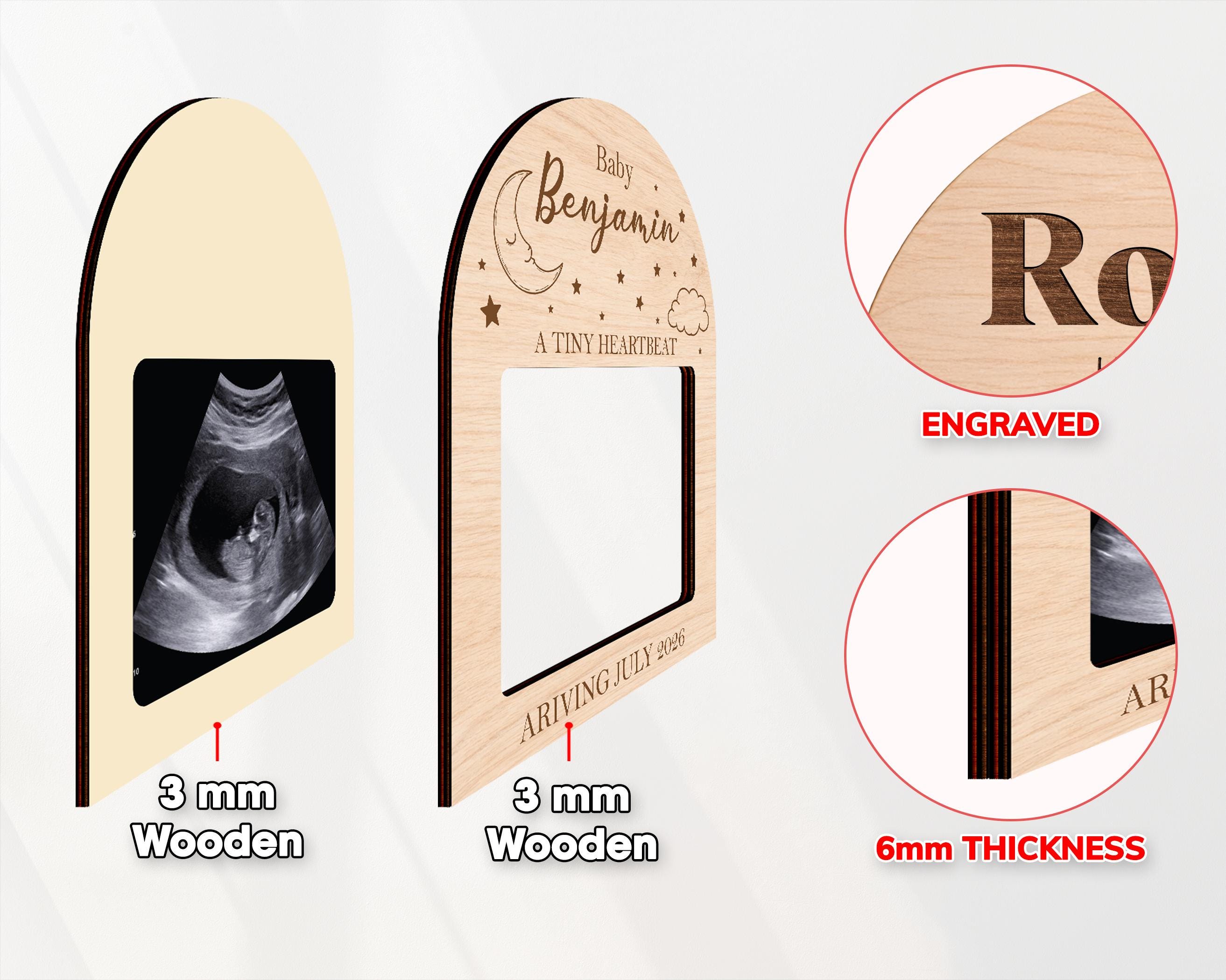 Sonogram Magnets Personalized Ultrasound Picture Frame Magnet, Custom Pregnancy ...