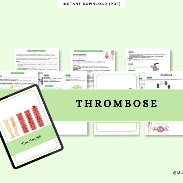 Thrombose Lernzettel Pflegeausbildung | Zusammenfassung | Medizin