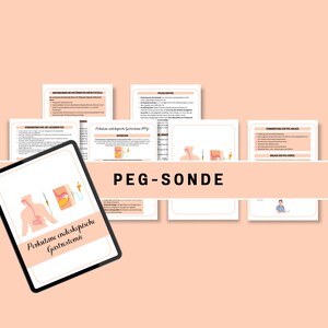 Puede incluir: Una ilustración digital de una sonda PEG, un tipo de tubo de alimentación, insertado en el estómago. La ilustración muestra el tubo pasando por la nariz y bajando por el esófago hasta el estómago. El texto "PEG-SONDE" está en negrita, en fuente grande en la parte superior de la imagen.