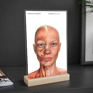 Può includere: Un espositore in acrilico trasparente con una base in legno mostra un'illustrazione anatomica dettagliata dei muscoli del viso. L'immagine mostra il viso di una persona con i muscoli evidenziati in rosso e arancione. L'espositore ha il testo "Dettagli del trattamento:" e "Note aggiuntive:" stampato su di esso.