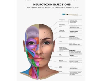 Neurotoxin Injections Treatment Areas, Muscles Targeted, Results - Medical Spa Decor Consult Client Education Esthetician Nurse Matte Poster