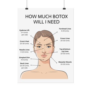 How Much Botox Will I Need Rolled Poster, Facial Anatomy Muscles Rolled ...