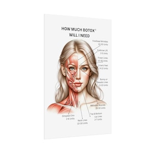 Póster de anatomía facial con músculos enrollados, póster de cuánto bótox necesitaré, póster de enfermera inyectora de MedSpa, póster de neurotoxina bótox