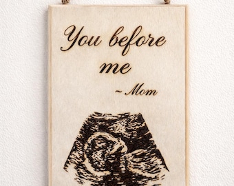 Custom Ultrasound Wood Burn Art | Baby Sonogram Keepsake Memory Sign
