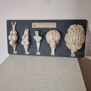 Puede incluir: Una vitrina vintage que muestra siete modelos anatómicos de cerebros, incluido un cerebro humano, en una pizarra negra con una etiqueta que dice "Sistema nervioso cerebroespinal, Modelos reales al tamaño y disposición de las partes, Fabricado por A.E. Staley, Chicago, Ill."