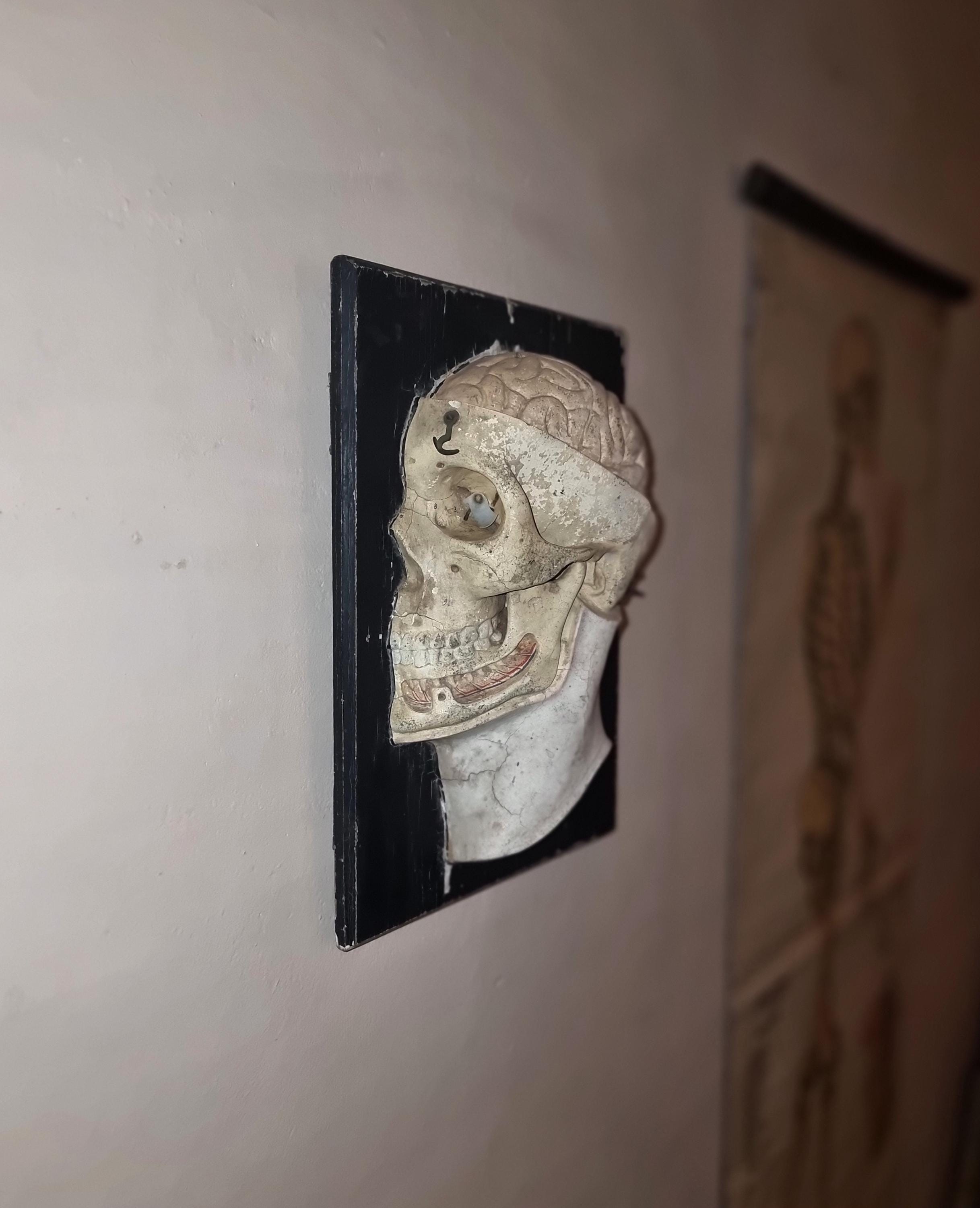 Antique anatomical model of a human head. Somso 19th century