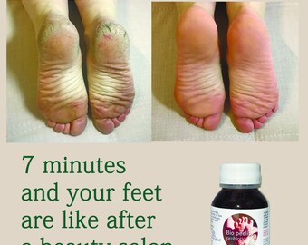 Foot and Hand Natural Biopeeling, Dead Skin Scrubber, Enzymatic Bio-Peeling based on fruit acid concentrate and 15 probiotic