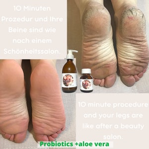 Foot and Hand Natural Bio-Peeling, Dead Skin Scrubber, Enzymatic Bio-Peeling based on fruit acid concentrate and 15 probiotic