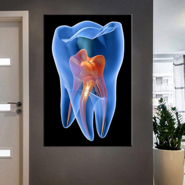 X-ray Molar Tooth, Dental Art, Dentist Art, Dental Clinic Deco Canvas Wall Art (5 options de couleur)