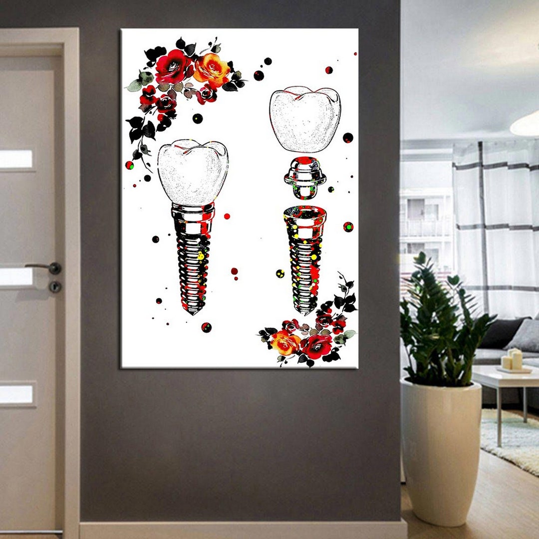 Denist Wall Art, Dentist ,implant Tooth, Dental Wall Art, Canvas Wall