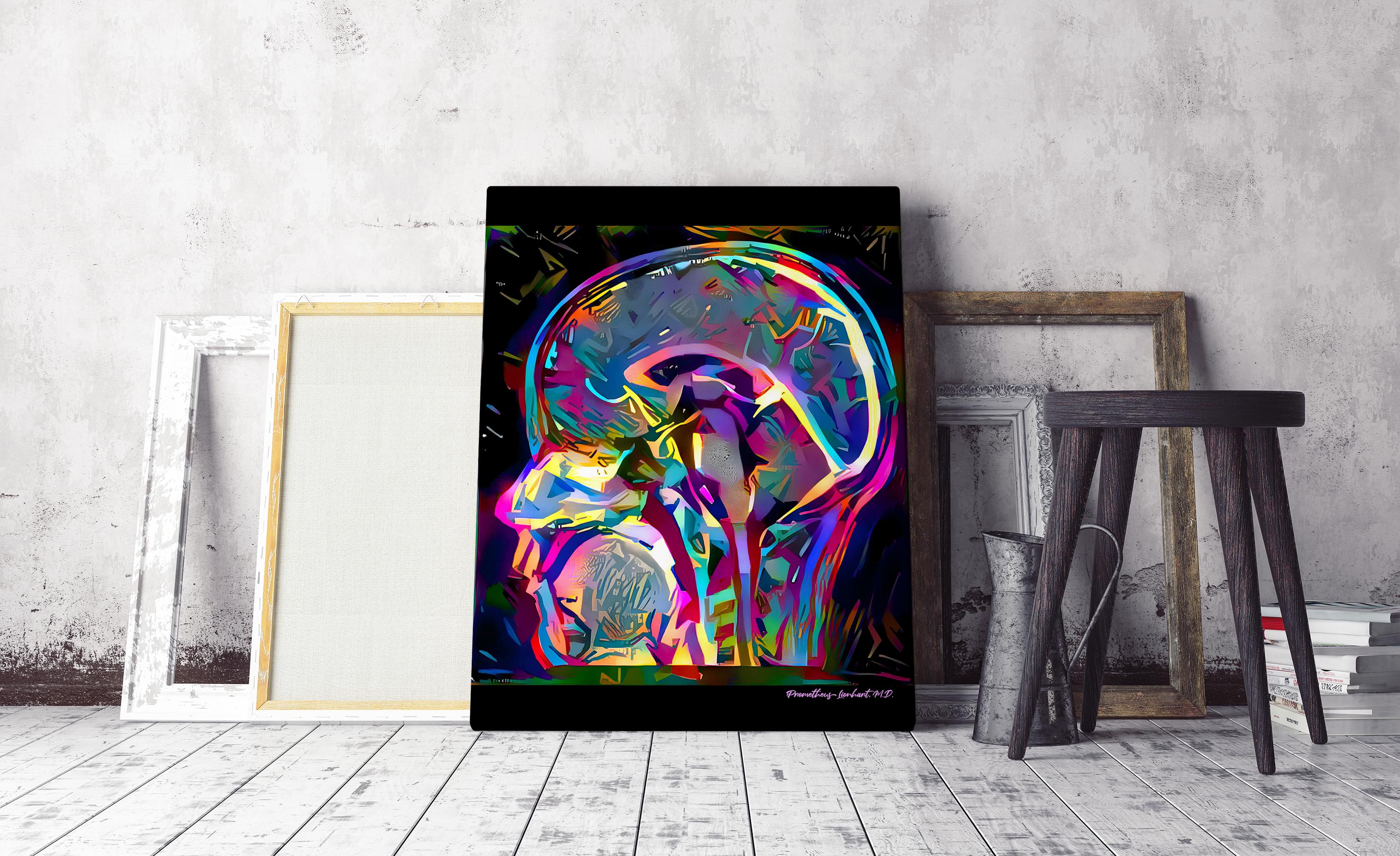 Brain Anatomy in Pop Art Style - Ready to Hang Canvas, Bright