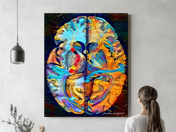 Brain Anatomy Art, Canvas or Acrylic, “alba Materia Cerebri