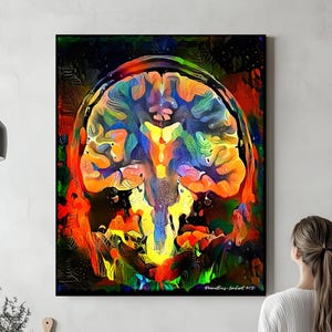 Brain Anatomy Art, Ready to Hang Canvas, Radiology Wall Art Science Medical Art Student Art Office Gifts Medicine