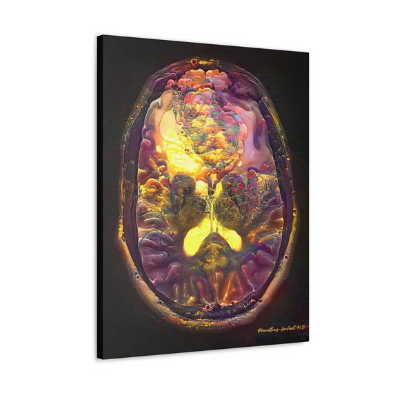 Brain Anatomy Brain Tumor, Ready to Hang Canvas, Radiology