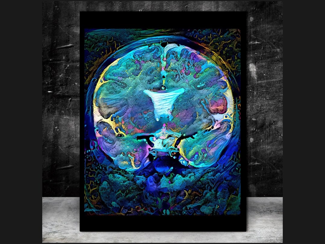 Brain Anatomy Art, Ready to Hang Canvas, Radiology Wall Art Science ...