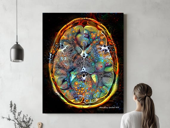 Brain Anatomy Globes Canvas Print, Radiology Wall Art for Science
