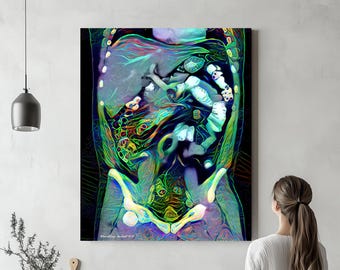 Abdominal Anatomy, Canvas or Acrylic, “Viridi Iecur” Radiology Art for Body Imager, Hepatologist, Medical Student, or Surgeon