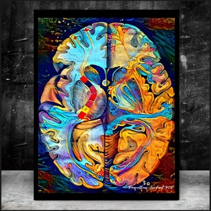 Brain Anatomy Art, Canvas, White Matter Map Version Radiology Wall Art Science Medical Art Student Art Office Gifts Medicine